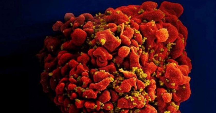 Johnson & Johnson HIV vaccine trial fails mid-stage study – ABC News