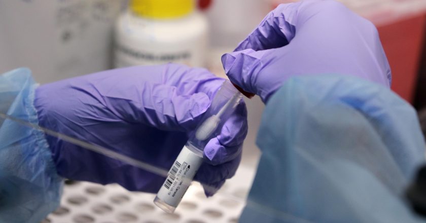 US tracking of virus variants has improved after slow start – Associated Press