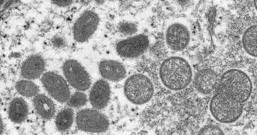 CDC expresses concern about possibility of undetected monkeypox spread in U.K. – STAT