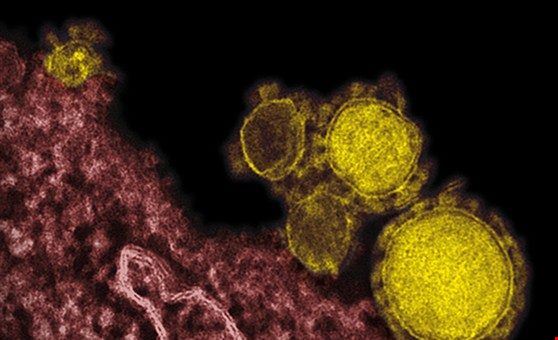 Groundbreaking: Scientists create an air filter that kills the coronavirus – Hot Air