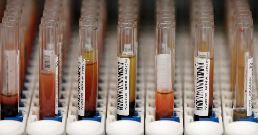 Your Blood Type May Affect COVID-19 Risk, But Its No Kind of Protection, Experts Say – ScienceAlert