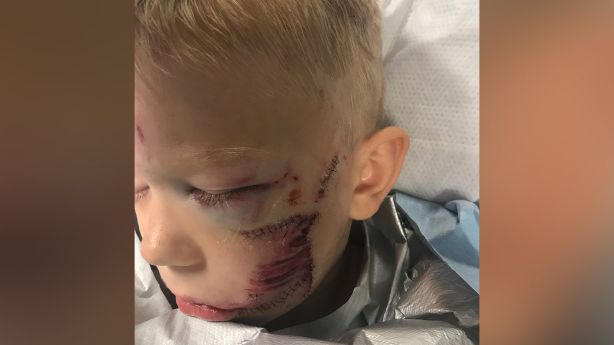 Real-life superhero: In saving sister, 6-year-old Wyoming boy takes brunt of dog attack – KSL.com