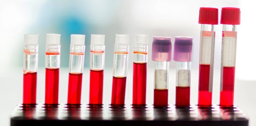 New Blood Test Detects 5 Types of Cancer Years Before Standard Diagnosis – ScienceAlert