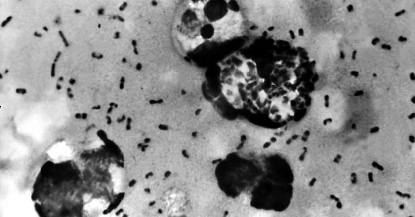 Case of human plague identified in Navajo County – FOX 10 News Phoenix