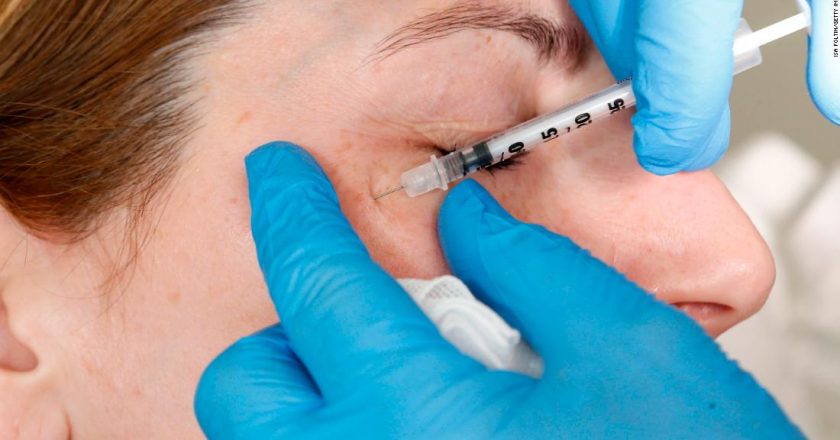 Botox could ease depression in addition to wrinkles, study finds – CNN