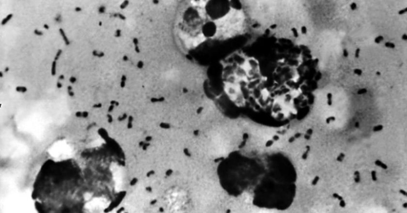 China reports case of suspected bubonic plague in Inner Mongolia – CBS News