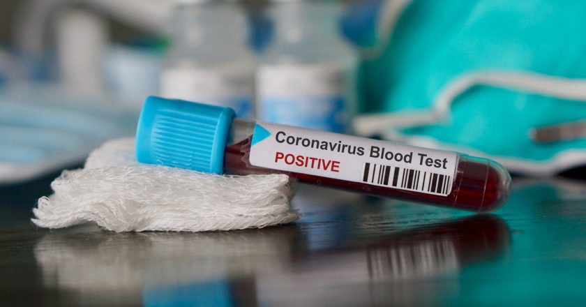 Coronavirus: Ventura Countys positive test rate climbs past state threshold – VC Star