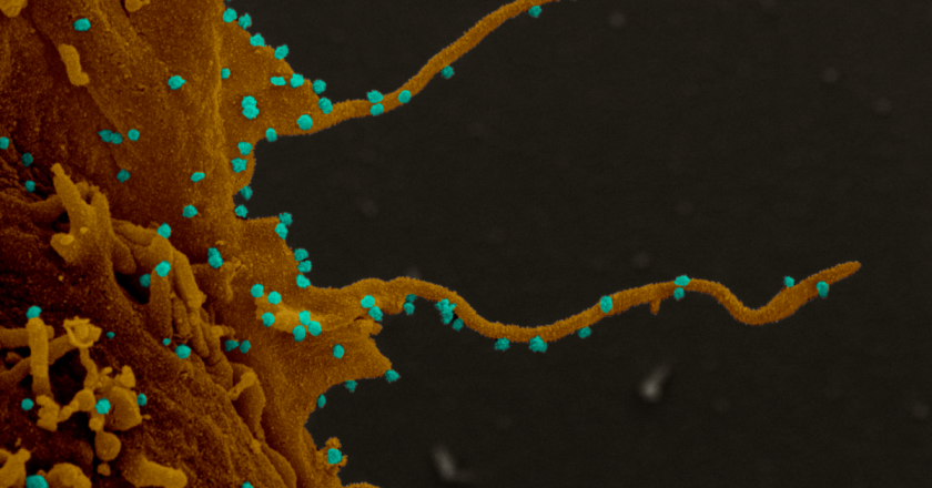 Coronavirus hijacks cells, forces them to grow tentacles, then invades others – Livescience.com