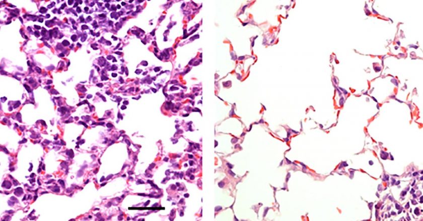 Single Dose of Nasal Vaccine Against COVID-19 Prevents Infection in Mice – Works Better Than Injection – SciTechDaily