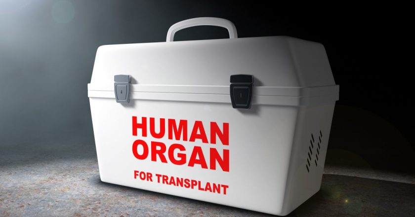 What happens to your body when youre an organ donor? – Livescience.com