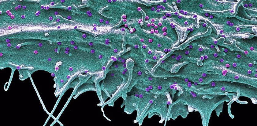 Super Rare Elite Controllers Are Able to Completely Overcome HIV Without Any Drugs – ScienceAlert