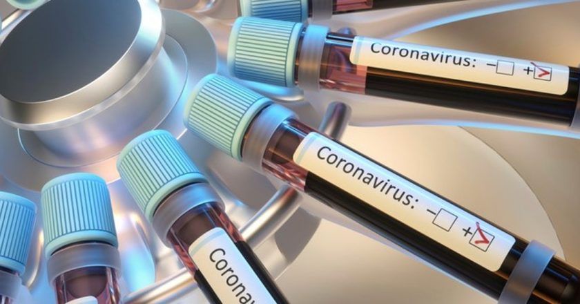 NY Times: Up To 90% Of People Who Test Positive For COVID-19 No Longer Contagious, Dont Need To Isolate – The Daily Wire