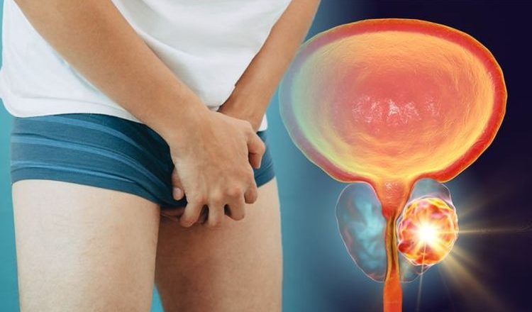 Prostate cancer symptoms: The one sign of the deadly disease all men should look out for – Express