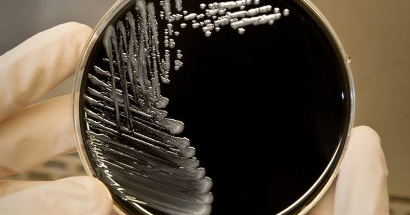 Health department investigating cluster of Legionnaires disease in N.J. that has left 2 dead – NJ.com