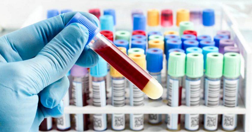 Blood test can predict psychotic disorders years before they develop – Study Finds