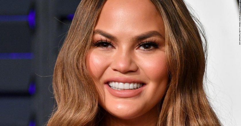 Chrissy Teigen is using Botox to treat really bad pregnancy headaches – CNN