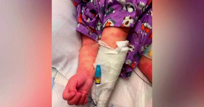 65 pediatric patients in Florida diagnosed with rare condition – WJXT News4JAX