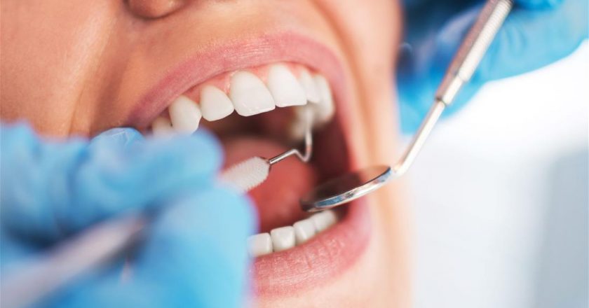 Dentist Details Epidemic of Cracked Teeth Due to Coronavirus Stress Leading to Teeth Grinding – Newser