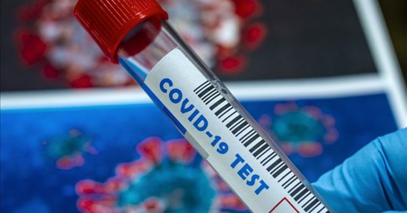 Positive tests, rate for coronavirus in Wisconsin decrease for second day in a row – WBAY