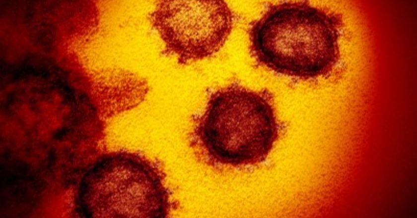 12 more dead as health officials confirm nearly 1,200 more coronavirus cases – Channel3000.com – WISC-TV3