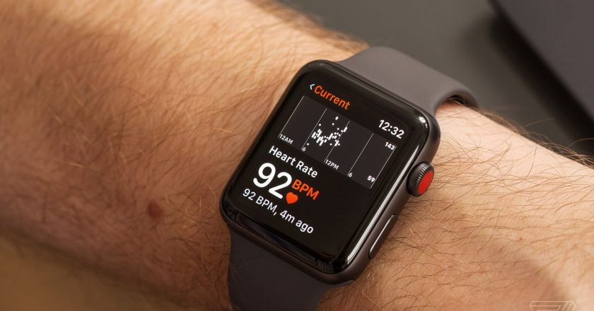 The Apple Watch heart monitor sends too many people to the doctor – The Verge