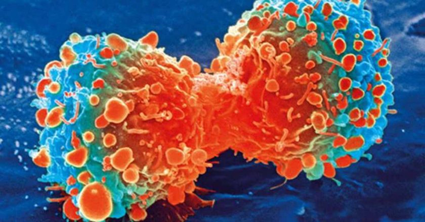 Revolutionary CRISPR-based Genome Editing System Destroys Cancer Cells Permanently in Lab – Good News Network