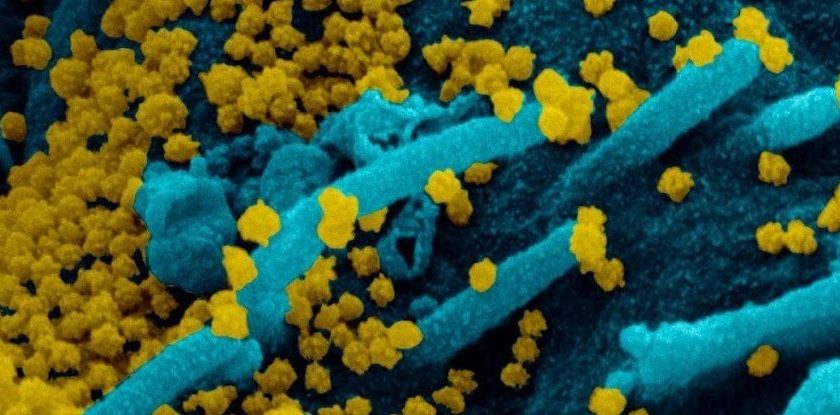 Startling Case Study Finds Asymptomatic COVID-19 Carrier Who Shed Virus For 70 Days – ScienceAlert