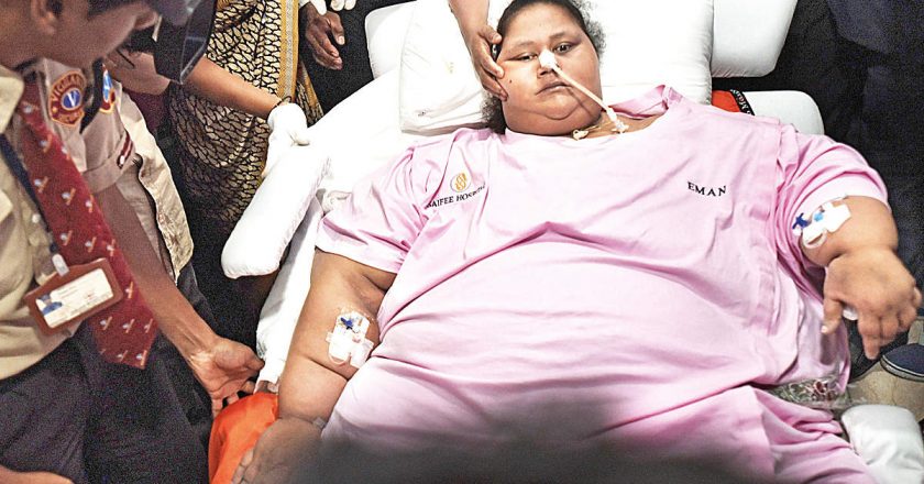 Bariatric surgery not cosmetic procedure, tax tribunal rules – Mumbai Mirror