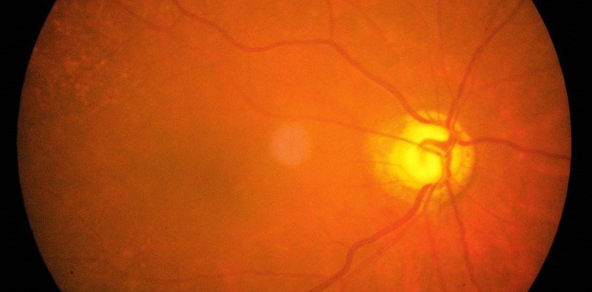 Scientists Just Successfully Regenerated Mouse Optic Nerve Cells in The Lab – ScienceAlert