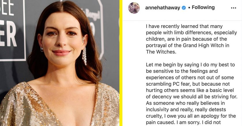 Anne Hathaway Has Apologised For “Pain” Caused By Portrayal Of Limb Difference In “The Witches” – BuzzFeed