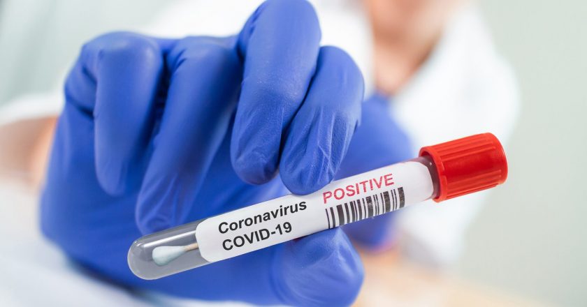 Coronavirus antibodies could last 6 months or more: Study – Fox News