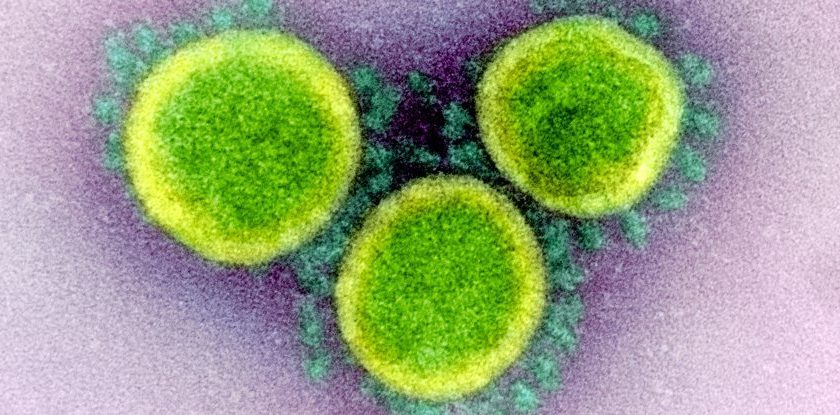 Scientists Just Found a Mysteriously Hidden Gene Within a Gene in SARS-CoV-2 – ScienceAlert