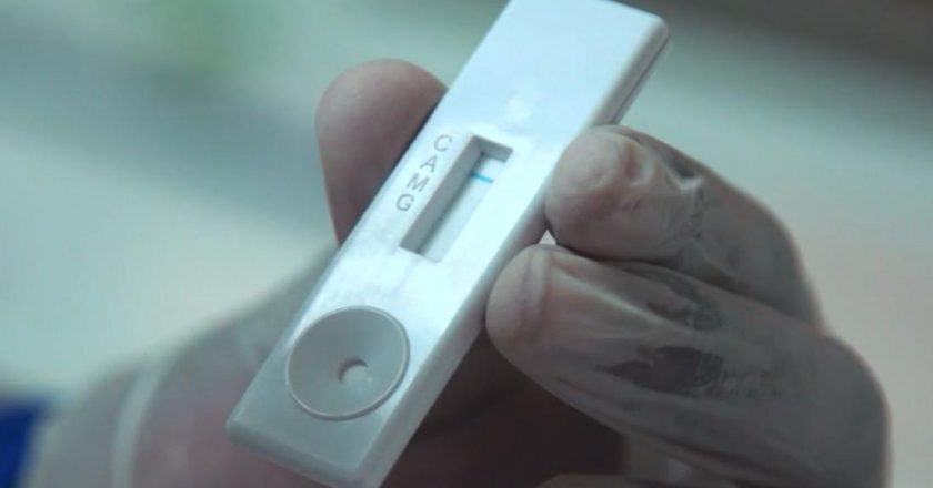 This $1 made-in-Africa Covid-19 test kit could revolutionize testing on the continent – CNN