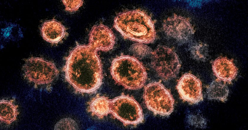 Virus variant from UK identified in Kansas – WDAF FOX4 Kansas City