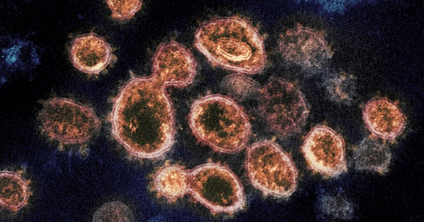 Another case of highly contagious COVID variant reported in Trenton – NJ.com