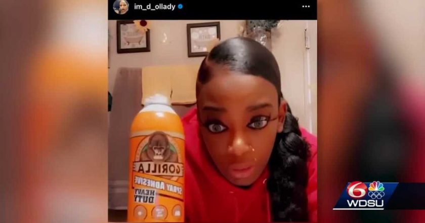 Louisiana woman offered free plastic surgery after using Gorilla glue as hair spray – WDSU New Orleans