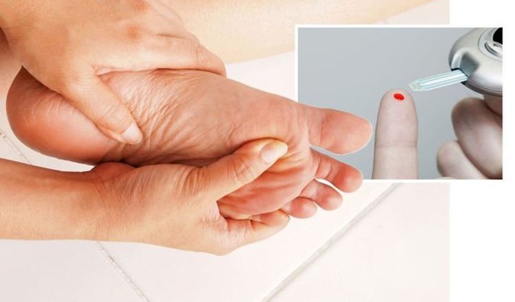 Diabetes type 2 symptoms: Three serious signs of blood sugar damage in your feet – Daily Express