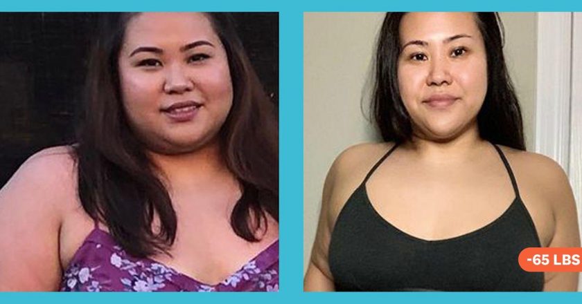 I Lost 65 Pounds After I Went Sugar-Free And Started Doing Intermittent Fasting – Yahoo Lifestyle