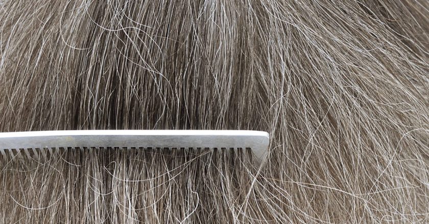 Reducing Stress Can Sometimes Reverse Gray Hair, Study Finds – Gizmodo