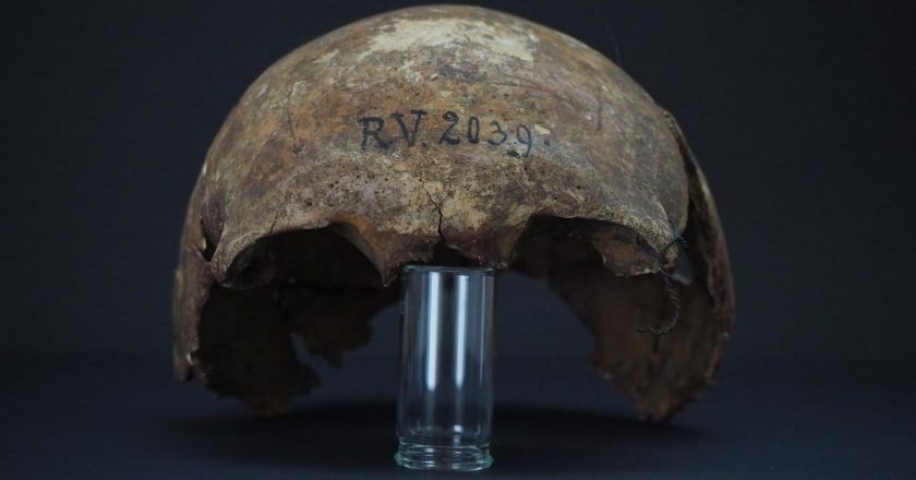 Scientists Say Theyve Found the Earliest Case of the Plague Yet – Gizmodo