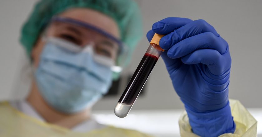 Theranos is history, but big blood testing breakthroughs are coming post-Covid – CNBC