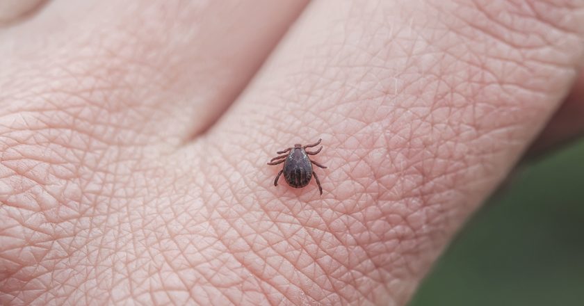 Connecticut confirms 2 Powassan virus infections: What to know about tick-borne illness – Fox News