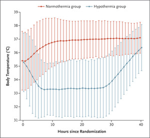 Hypothermia versus Normothermia after Out-of-Hospital Cardiac Arrest | NEJM – nejm.org