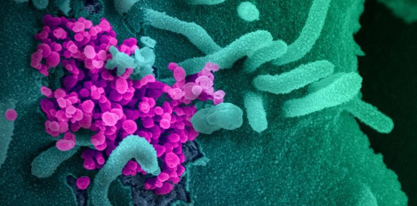 Theres a New Review of Potential SARS-CoV-2 Origins. Heres What Experts Think – ScienceAlert