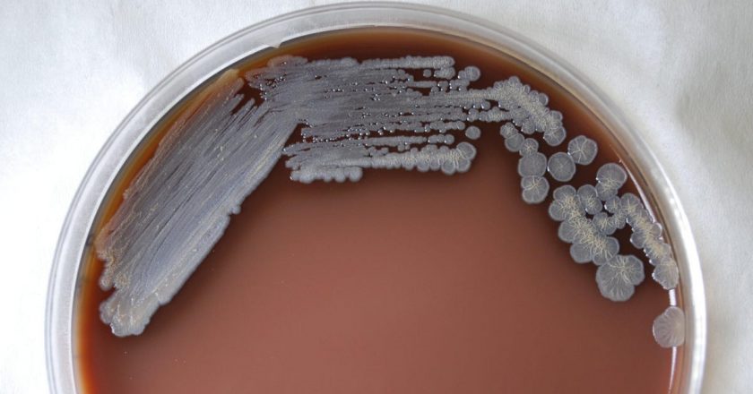 CDC Warns Doctors About a Mystery Bacterial Outbreak With No Clear Origin – Gizmodo