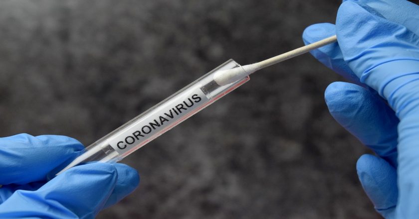 New coronavirus variants seen as too contagious for hotel quarantines – Fox News