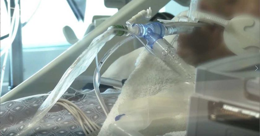 10 children on life support as Mississippi sees surge in delta variant cases – WAPT Jackson