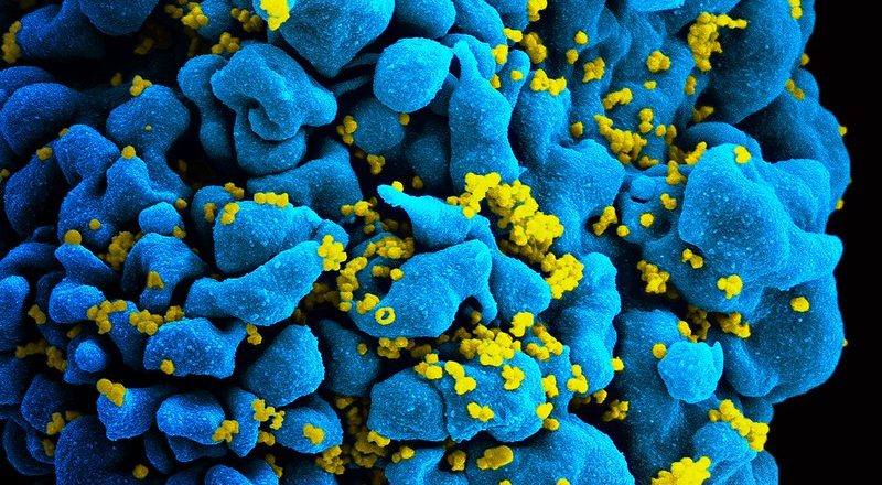 HIV Vaccine Candidate Does Not Sufficiently Protect Women Against HIV Infection – National Institutes of Health