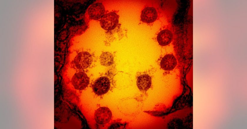 Cholesterol drug cuts coronavirus infection by 70%, researchers find – FOX 32 Chicago