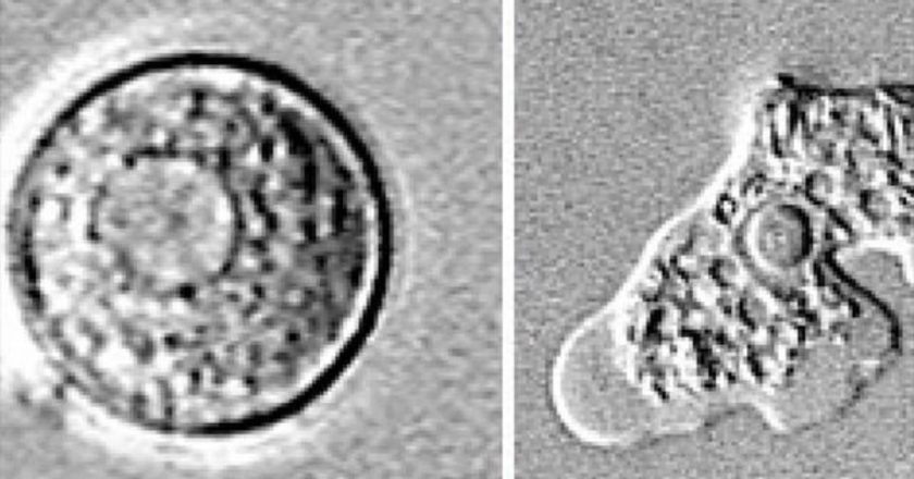 7-year-old dies from rare brain-eating amoeba tied to California lake – CBS News